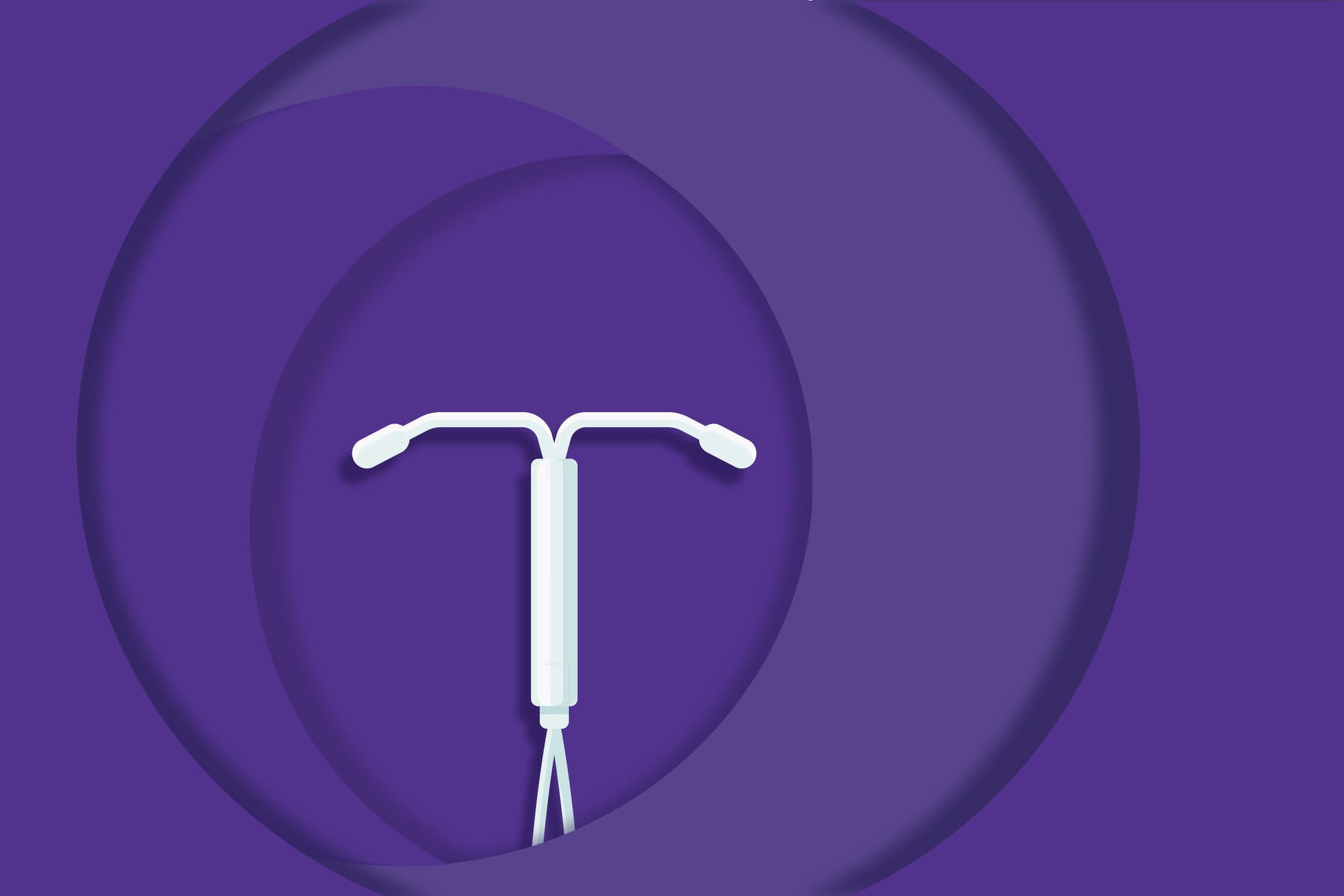 An illustration of an IUD birth control device.