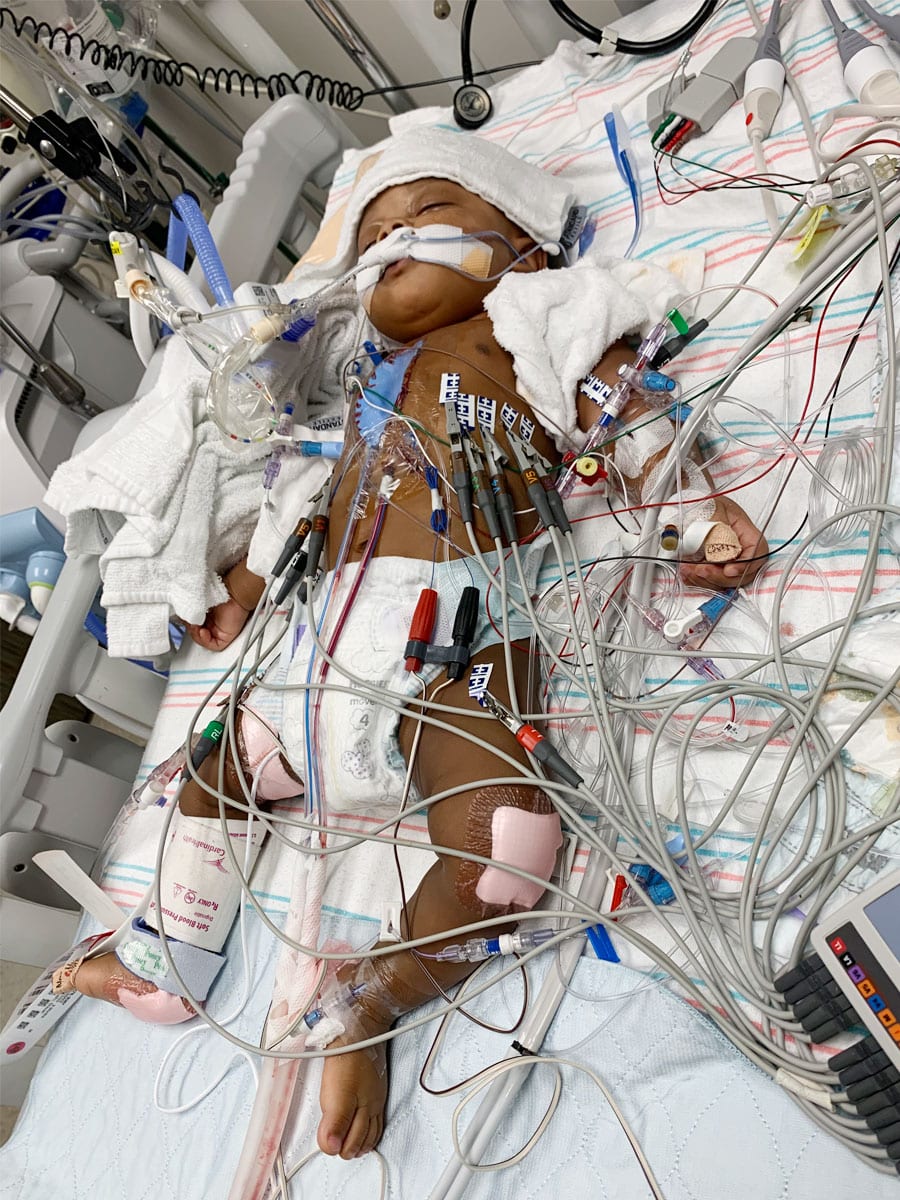 Baby Imani lying in the NICU.