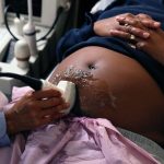 A doctor gives a pregnant person an ultrasound as they lays.