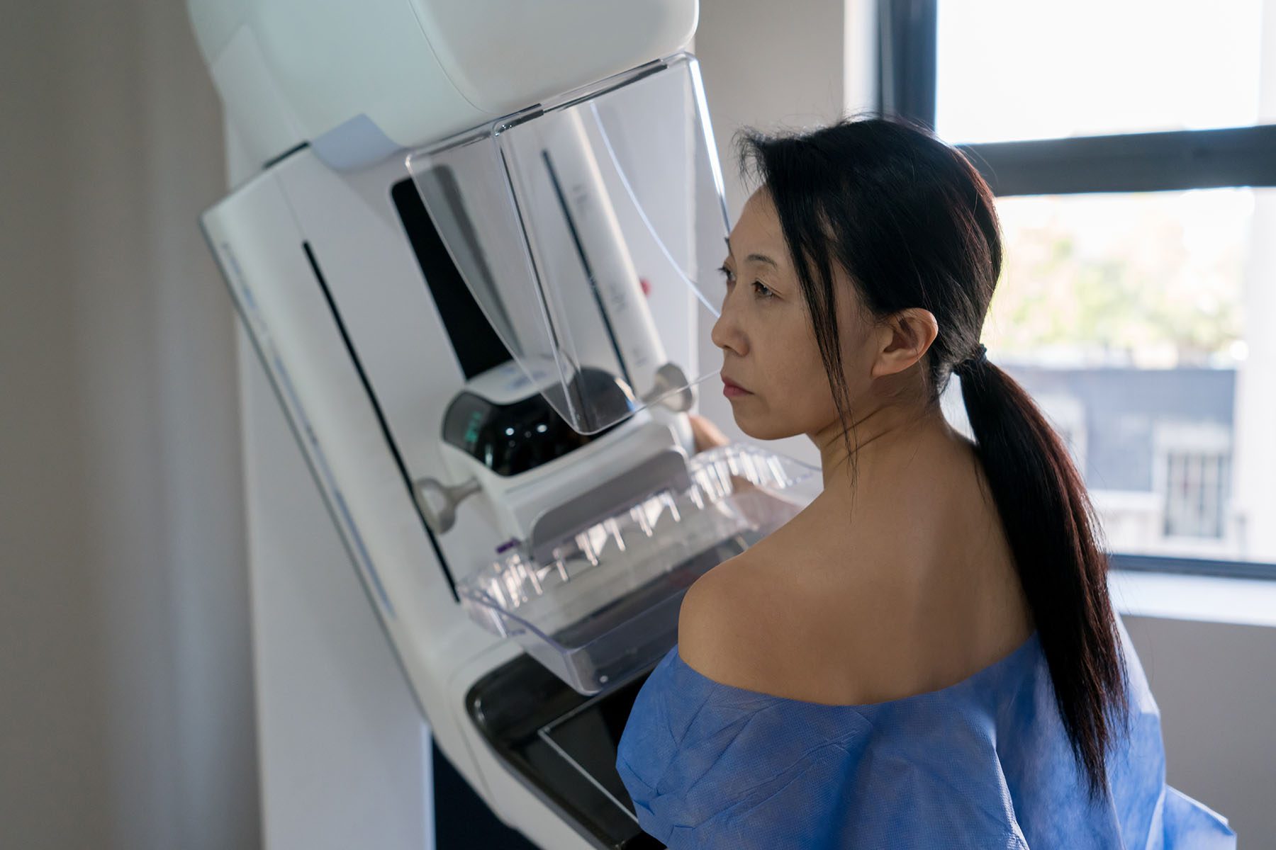 Asian female patient at a hospital getting a mammogram exam wearing a hospital gown and looking serious.