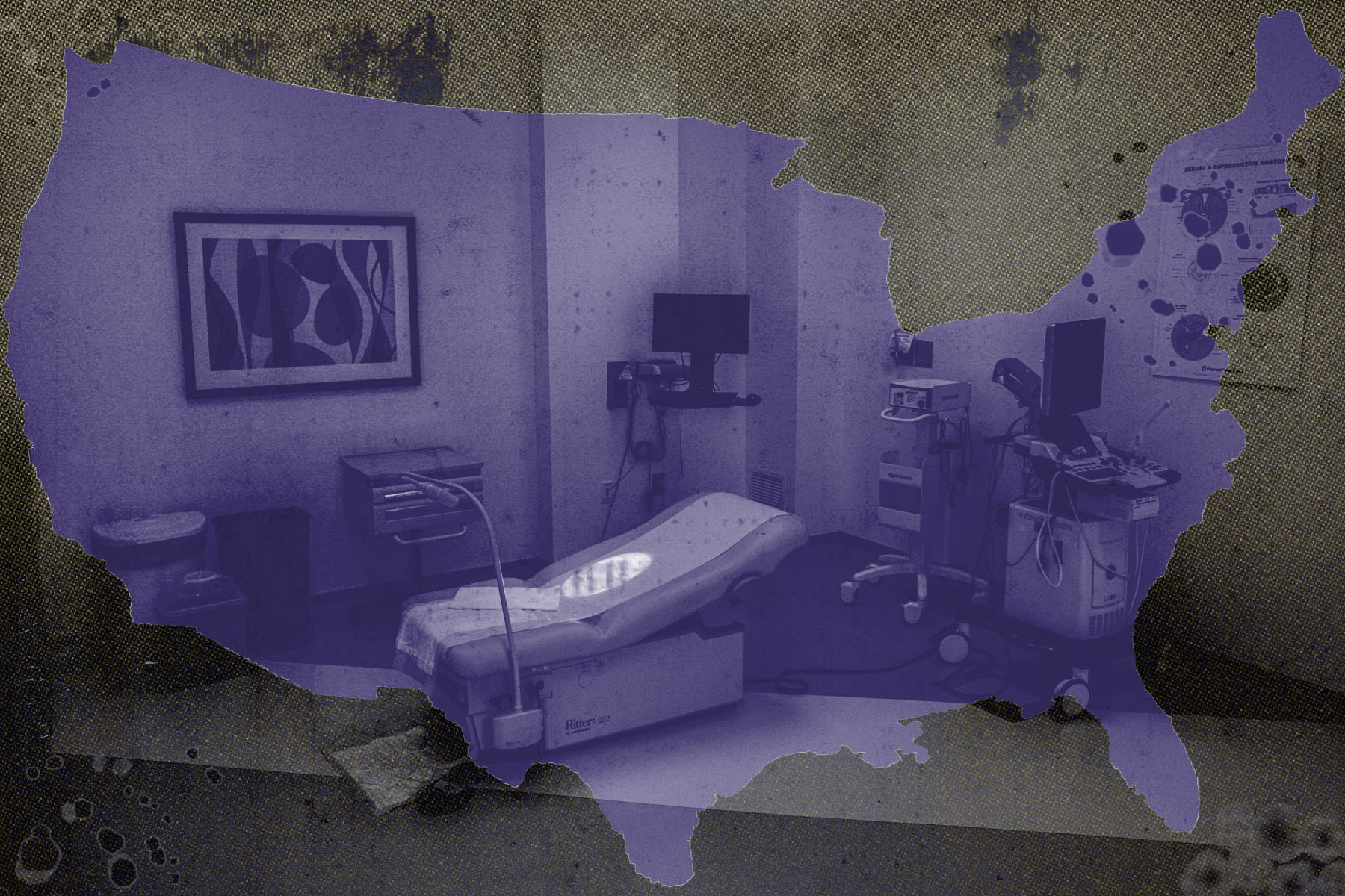 Photo illustration of a map of the continental united states superimposed on an empty consultation room in an abortion clinic.