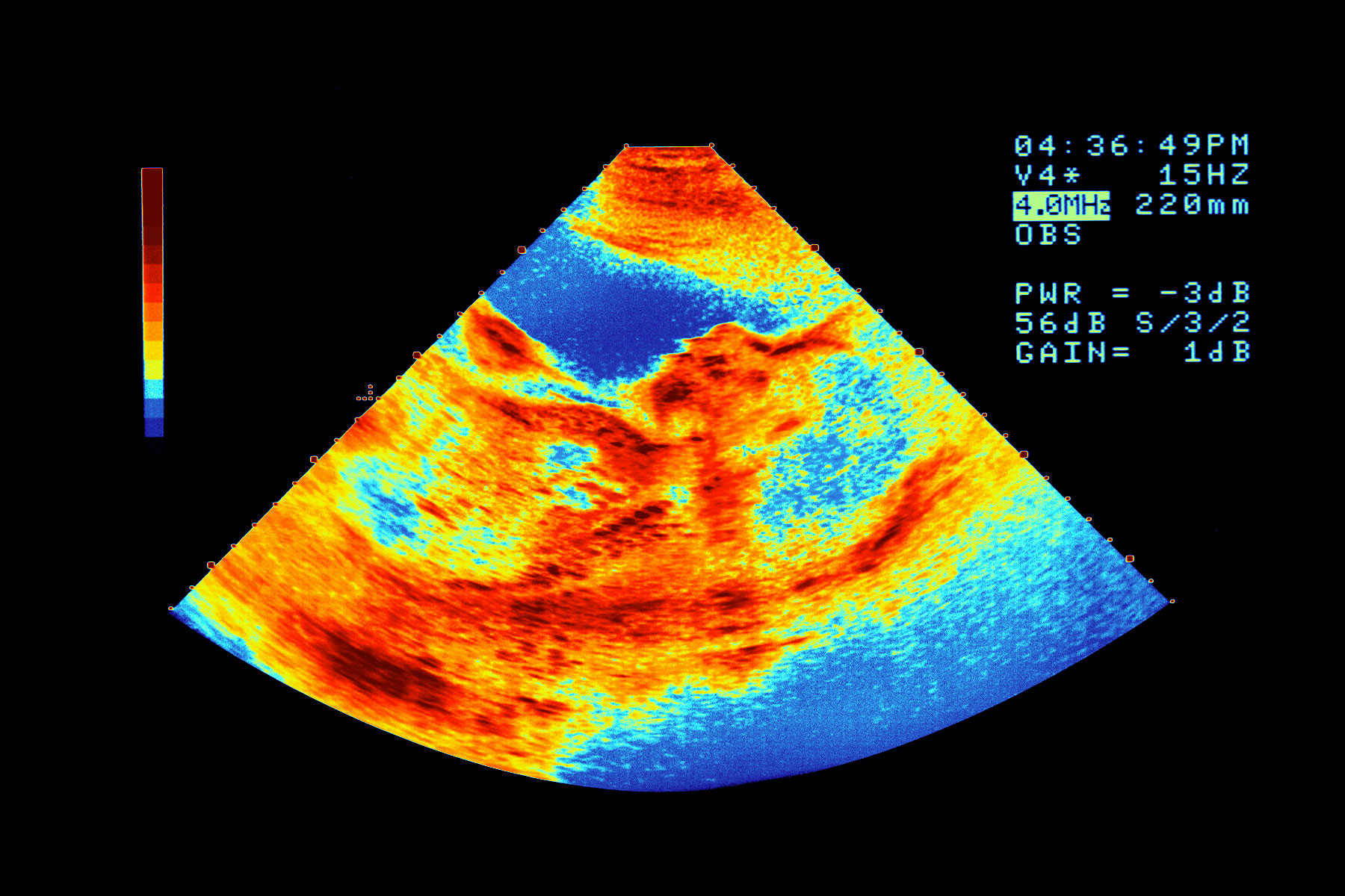 A photo illustration of a sonogram with a thermal map color gradient.