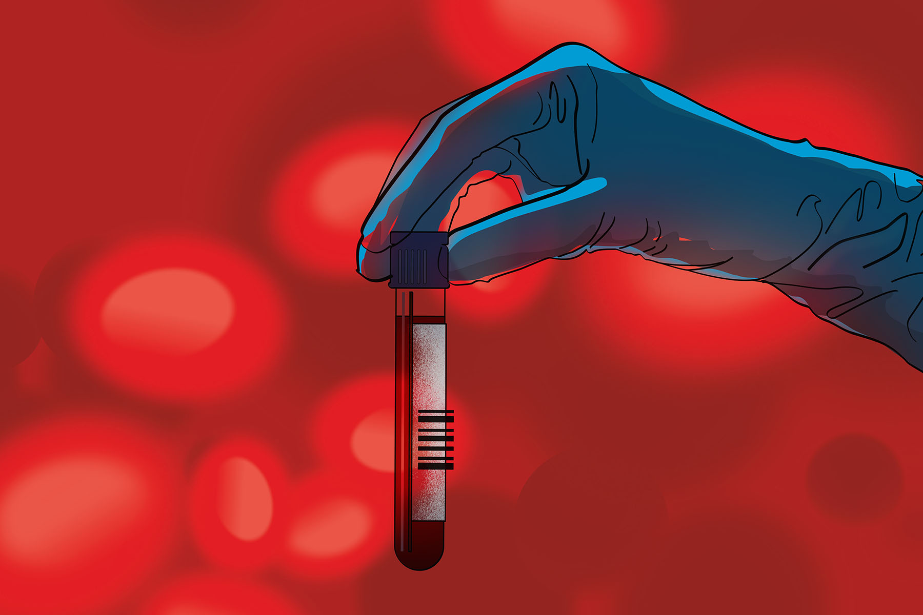 Illustration of gloved hand holding a blood sample.