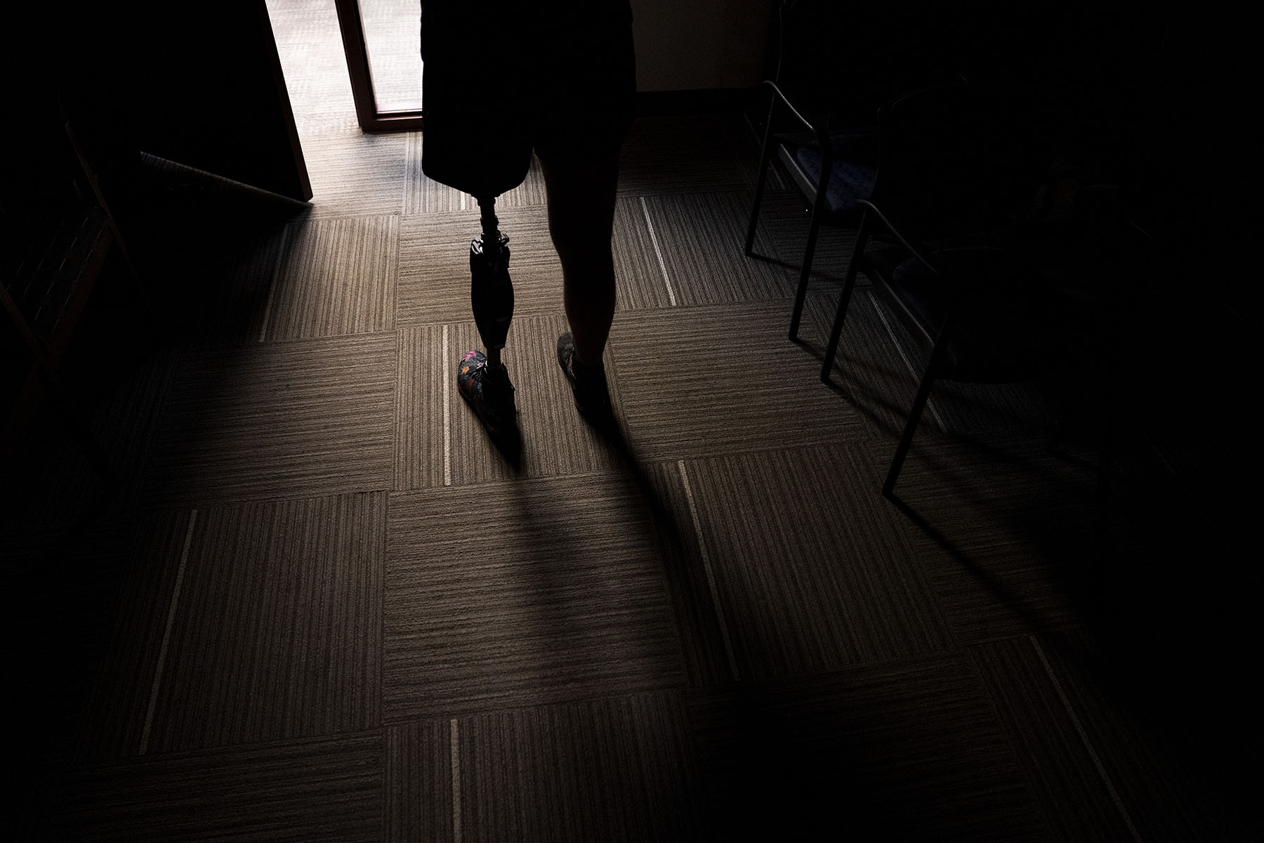 A person wearing a prosthetic leg stands in a doorway.